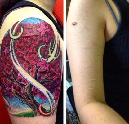 Tatuaggi sulla Spalla per Chiudere le Cicatrici - Una Guida